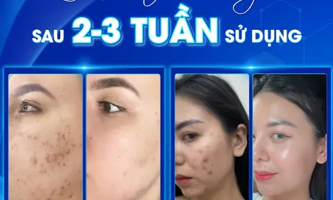 Tái sinh làn da thâm mụn kéo dài cùng Coonme