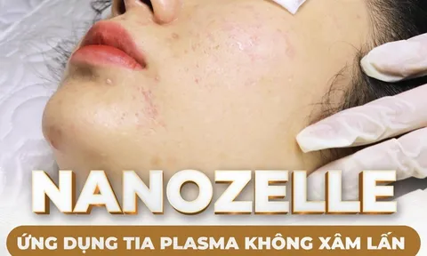 Độc quyền Công nghệ Nanozelle Plasma và máy plasma blast tại Việt Nam