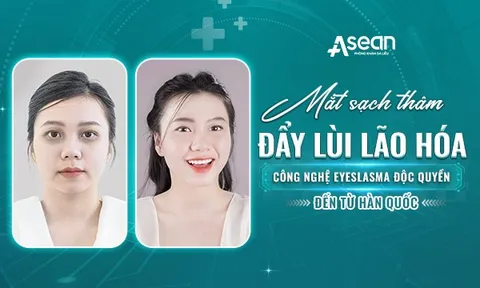 Mắt sạch thâm, đẩy lùi lão hóa bằng Công nghệ hàng đầu Hàn Quốc - Eyeslasma