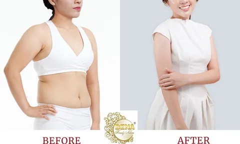 Thẩm mỹ viện giảm béo An toàn - Uy tín - Hiệu quả tại Quảng Bình