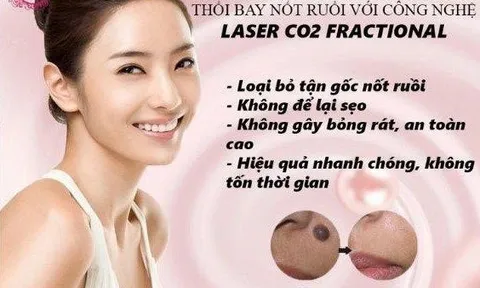 Tẩy nốt rồi tại Thẩm mỹ viện BENA USA: Không đau – An toàn – Hiệu quả nhanh chóng