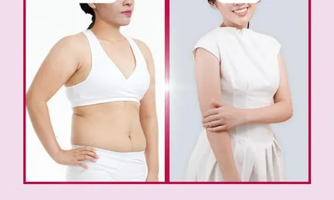 Công nghệ giảm béo Ultra Lipo an toàn – hiệu quả - không đau